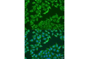 Immunofluorescence analysis of U2OS cells using  antibody  at dilution of 1:100. (ADAP1 antibody  (AA 1-374))