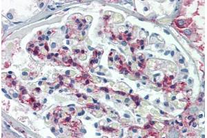 Human Kidney: Formalin-Fixed, Paraffin-Embedded (FFPE) (METTL7B antibody  (C-Term))