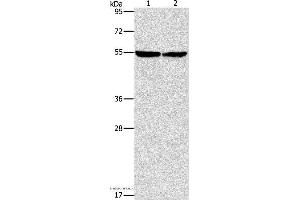 Western blot analysis of Mouse heart tissue and hela cell, using ILK Polyclonal Antibody at dilution of 1:600 (ILK antibody)
