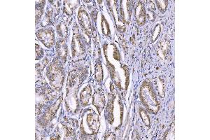 IHC analysis of TOM1L1 using anti-TOM1L1 antibody (ABIN7602631).