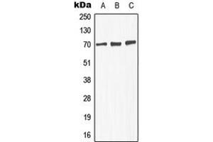 Western blot analysis of GABRA4 expression in MCF7 (A), SP2/0 (B), PC12 (C) whole cell lysates.