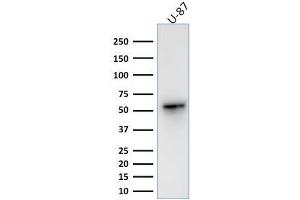 Western Blot Analysis of human U-87 cell lysate using Vimentin Rabbit Recombinant Monoclonal Antibody (VIM/1937R). (Recombinant Vimentin antibody)