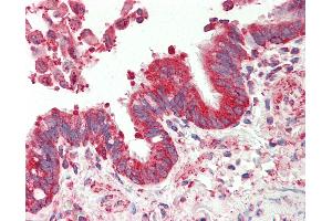 Anti-TSPAN12 antibody IHC staining of human lung, respiratory epithelium. (TSPAN12 antibody  (AA 185-234))