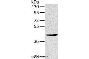 Western blot analysis of A431 cell, using TNIP2 Polyclonal Antibody at dilution of 1:500 (TNIP2 antibody)