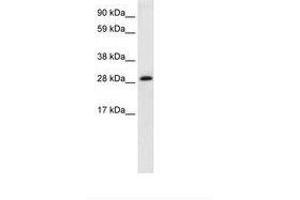 Image no. 2 for anti-Activator of Basal Transcription 1 (Abt1) (AA 174-223) antibody (ABIN202142)