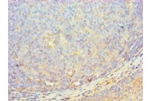 Immunohistochemistry of paraffin-embedded human tonsil tissue using ABIN7174047 at dilution of 1:100 (MERTK antibody  (AA 840-999))