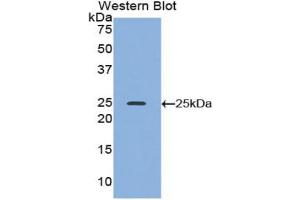 Western blot analysis of the recombinant protein. (ADH1 antibody  (AA 25-228))