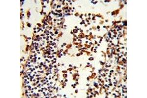 IHC analysis of FFPE human lymph tissue stained with IGHA1 antibody (IGHA1 antibody  (AA 257-286))