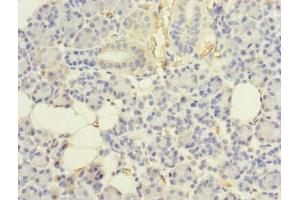 Immunohistochemistry of paraffin-embedded human pancreatic tissue using ABIN7174455 at dilution of 1:100 (UBE2G2 antibody  (AA 1-165))