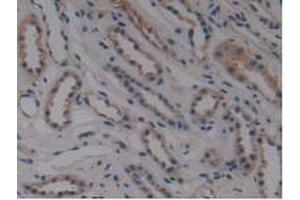 Detection of MPP6 in Human Kidney Tissue using Polyclonal Antibody to Membrane Protein, Palmitoylated 6 (MPP6) (MPP6 antibody  (AA 331-503))
