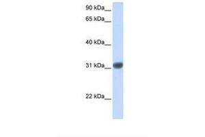 Image no. 1 for anti-Orthodenticle Homeobox 2 (OTX2) (AA 110-159) antibody (ABIN6737647)