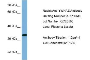 WB Suggested Anti-YWHAE Antibody   Titration: 1. (YWHAE antibody  (C-Term))