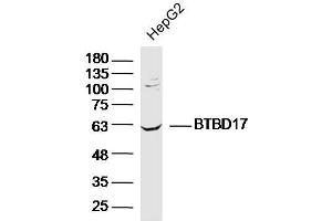Lane 1: HepG2 lysates probed with BTBD17 Polyclonal Antibody, Unconjugated  at 1:300 overnight at 4˚C. (BTBD17 antibody  (AA 101-200))