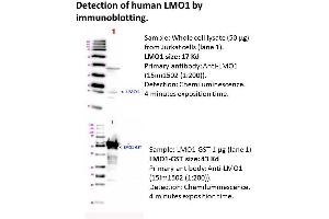 Image no. 1 for anti-LIM Domain Only 1 (Rhombotin 1) (LMO1) antibody (ABIN1112421) (LMO1 antibody)