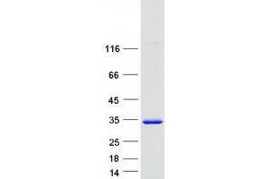PSMA3 Protein (Transcript Variant 1) (Myc-DYKDDDDK Tag)