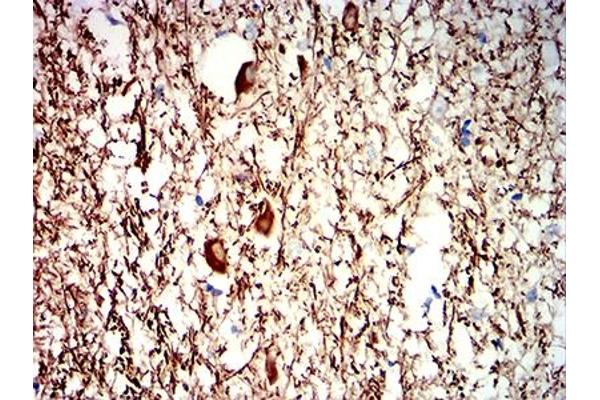 NEFH antibody  (AA 2-251)