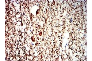 Immunohistochemical analysis of paraffin-embedded human medulla oblongata tissues using NEFH mouse mAb with DAB staining. (NEFH antibody  (AA 2-251))