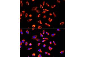 Immunofluorescence (IF) image for anti-Glycine Cleavage System H Protein (GCSH) (AA 1-173) antibody (ABIN6141032)