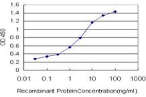 Detection limit for recombinant GST tagged ZIC3 is approximately 0. (ZIC3 antibody  (AA 182-274))