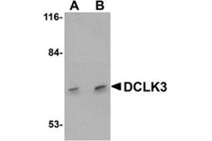 Western blot analysis of DCLK3 in K562 cell lysate with AP30278PU-N DCLK3 antibody at (A) 1 and (B) 2 μg/ml.