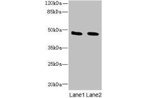Western blot All lanes: IGSF11 antibody at 1. (IGSF11 antibody  (AA 23-241))
