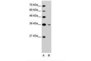 Image no. 2 for anti-Granzyme H (Cathepsin G-Like 2, Protein H-CCPX) (GZMH) (N-Term) antibody (ABIN203444) (GZMH antibody  (N-Term))