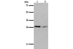 Western Blot analysis of Mouse brain and kidney tissue using KLK7 Polyclonal Antibody at dilution of 1:600