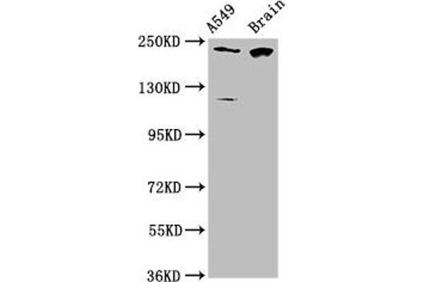 CABIN1 Antikörper  (AA 1978-2123)