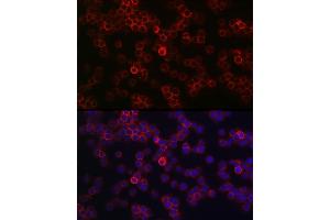 Immunofluorescence analysis of Jurkat cells using CD45 Rabbit pAb (ABIN3022953, ABIN3022954, ABIN3022955, ABIN1513451 and ABIN6219315) at dilution of 1:100 (40x lens). (CD45 antibody  (AA 890-990))