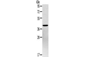 Western Blotting (WB) image for anti-Pentraxin 3 (PTX3) antibody (ABIN2434027) (PTX3 antibody)