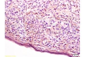 Formalin-fixed and paraffin embedded human skin of vulva tissue labeled with Anti-Cathepsin D Polyclonal Antibody, Unconjugated (ABIN732098) at 1:200 followed by conjugation to the secondary antibody, (SP-0023), and DAB staining (Cathepsin D antibody  (AA 101-200))