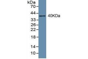 WB of Protein Standard: different control antibodies against Highly purified E. (PINP ELISA Kit)