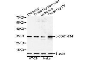 Western blot analysis of extracts of HT-29 and HeLa cells, using Phospho-CDK1-T14 antibody (ABIN5969876) at 1/1000 dilution. (CDK1 antibody  (pThr14))