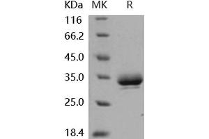 Western Blotting (WB) image for Erythropoietin Receptor (EPOR) (Active) protein (His tag) (ABIN7320425) (EPOR Protein (His tag))