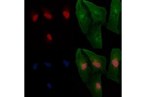 ABIN6265491 and ABIN6266698 staining  cells by IF/ICC. (TBX2/3 (Internal Region) antibody)