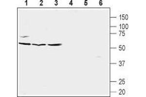 Western blot analysis of Burkitt's lymphoma (Raji) (lanes 1 and 4), human prostate carcinoma (LNCaP) (lanes 2 and 5) and human prostate carcinoma (PC-3) cell line lysates (lanes 3 and 6): - 1-3. (CXCR5 antibody  (Extracellular, N-Term))
