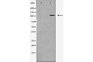 Western blot analysis of Hela whole cell lysates, using PARP1 Antibody. (PARP1 antibody  (Internal Region))