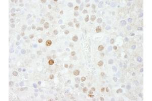 Immunohistochemistry (IHC) image for anti-Forkhead Box K1 (Foxk1) (AA 683-733) antibody (ABIN7448569)