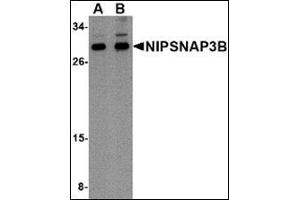 Western blot analysis of NIPSNAP3B in mouse brain tissue lysate with this product at (A) 1 and (B) 2 μg/ml. (NIPSNAP3B antibody  (Center))