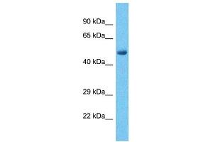 Host:  Rabbit  Target Name:  PHF15  Sample Type:  Liver Tumor lysates  Antibody Dilution:  1. (PHF15 antibody  (C-Term))