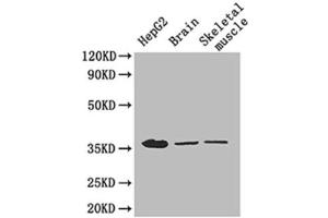 Western Blotting (WB) image for anti-Glyceraldehyde-3-Phosphate Dehydrogenase (GAPDH) (AA 3-105) antibody (ABIN2931072) (GAPDH antibody  (AA 3-105))