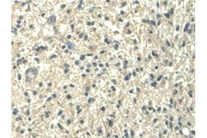 Immunohistochemistry (IHC) image for anti-Aldehyde Dehydrogenase 1 Family, Member A2 (ALDH1A2) (AA 1-422) antibody (ABIN7435901)