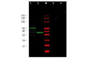 Western blot using  Affinity Purified anti-Yeast CHK1 antibody shows detection of a bands corresponding to CHK1 in Saccharomyces cerevisiae lysates. (CHEK1 antibody  (AA 312-327))