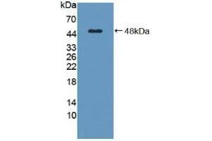 Detection of Recombinant C8g, Human using Polyclonal Antibody to Complement Component 8g (C8g) (C8G antibody  (AA 39-202))
