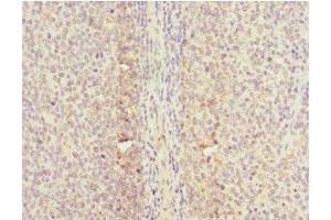 Immunohistochemistry of paraffin-embedded human tonsil tissue using ABIN7147293 at dilution of 1:100 (CDC7 antibody  (AA 275-574))