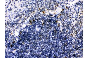 Anti- Ikaros Picoband antibody, IHC(P) IHC(P): Mouse Spleen Tissue (IKZF1 antibody  (C-Term))