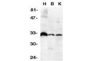 Western Blotting (WB) image for anti-Tumor Necrosis Factor Receptor Superfamily, Member 6b, Decoy (TNFRSF6B) (N-Term) antibody (ABIN2473237)