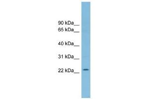 RNF125 antibody used at 1 ug/ml to detect target protein. (RNF125 antibody  (Middle Region))
