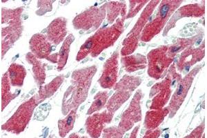 Human Heart (formalin-fixed, paraffin-embedded) stained with CRYAB antibody ABIN462098 at 10 µg/ml followed by biotinylated goat anti-rabbit IgG secondary antibody ABIN481713, alkaline phosphatase-streptavidin and chromogen. (CRYAB antibody)