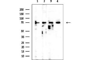 Western blot analysis of lysates from various samples, using MTHFR Mouse Monoclonal Antibody at 1/1000 dilution.